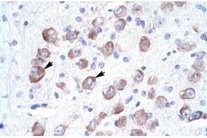 Immunohistochemical staining (Formalin-fixed paraffin-embedded sections) of human brain with LARP1 polyclonal antibody . (LARP1 Antikörper  (AA 701-750))