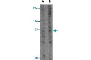 Western blot analysis of GRIK3 in human brain tissue lysate with GRIK3 polyclonal antibody  at (A) 1 and (B) 2 ug/mL . (GRIK3 Antikörper  (N-Term))