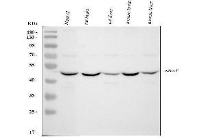 Western blot analysis of ABAT using anti-ABAT antibody (ABIN4886408). (ABAT Antikörper  (AA 388-500))