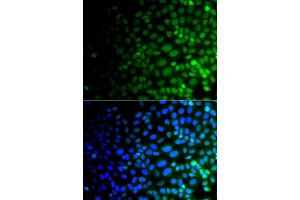 Immunofluorescence analysis of A549 cells using ULK4 antibody. (ULK4 Antikörper)