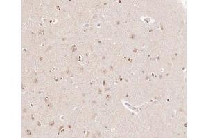 ABIN6266905 at 1/100 staining human brain tissue sections by IHC-P. (CKS2 Antikörper  (Internal Region))