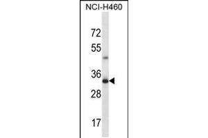 Western blot analysis in NCI-H460 cell line lysates (35ug/lane). (TBC1D21 Antikörper  (N-Term))