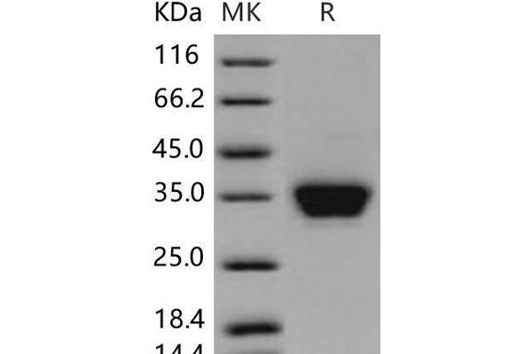 CLMP Protein (His tag)