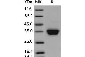 Western Blotting (WB) image for CXADR-Like Membrane Protein (CLMP) (Active) protein (His tag) (ABIN7320234)