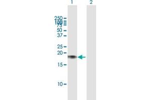 Western Blot analysis of CALM2 expression in transfected 293T cell line by CALM2 MaxPab polyclonal antibody. (Calmodulin 2 Antikörper  (AA 1-149))