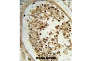 Formalin-fixed and paraffin-embedded human testis tissue reacted with ELOVL2 Antibody (N-term), which was peroxidase-conjugated to the secondary antibody, followed by DAB staining. (ELOVL2 Antikörper  (N-Term))