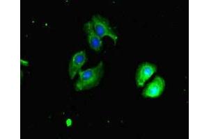 Immunofluorescent analysis of A549 cells using ABIN7147720 at dilution of 1:100 and Alexa Fluor 488-congugated AffiniPure Goat Anti-Rabbit IgG(H+L) (CHD4 Antikörper  (AA 1-219))