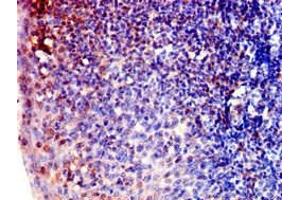 Immunohistochemistry of paraffin-embedded human tonsil tissue using ABIN7143081 at dilution of 1:100 (ARPC1B Antikörper  (AA 16-316))