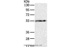 Western blot analysis of Human fat tissue, using PLIN1 Polyclonal Antibody at dilution of 1:250 (PLIN1 Antikörper)