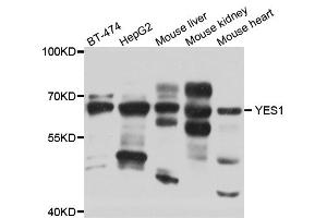 Western blot analysis of extracts of various cell lines, using YES1 antibody (ABIN5974700) at 1/1000 dilution. (YES1 Antikörper)