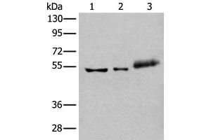 Western blot analysis of Hela cell Mouse kidney tissue and Human colorectal cancer tissue lysates using YY2 Polyclonal Antibody at dilution of 1:800 (YY2 Antikörper)