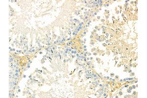 ABIN6263535 and ABIN6276581 at 1/100 staining Rat testis tissue by IHC-P.