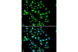 Immunofluorescence analysis of U20S cell using STAMBP antibody. (STAMBP Antikörper)