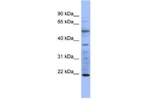 MYL3 antibody used at 1 ug/ml to detect target protein. (MYL3/CMLC1 Antikörper  (N-Term))