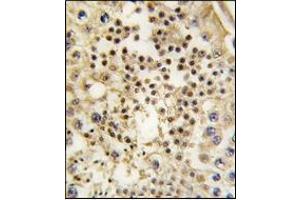 Immunohistochemistry (IHC) image for anti-Lin-28 Homolog A (C. Elegans) (LIN28A) antibody (ABIN356385) (LIN28A Antikörper)