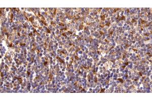 Immunohistochemistry (IHC) image for anti-Transglutaminase 2 (C Polypeptide, Protein-Glutamine-gamma-Glutamyltransferase) (TGM2) (AA 1-687) antibody (ABIN7434158)