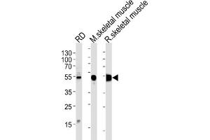 Western Blotting (WB) image for anti-Enolase 3 (Beta, Muscle) (ENO3) antibody (ABIN3001691) (ENO3 Antikörper)