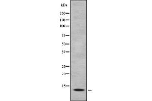 Western blot analysis of MK1I1 expression in HEK293 cells ,The lane on the left is treated with the antigen-specific peptide. (MAPKSP1 Antikörper  (Internal Region))