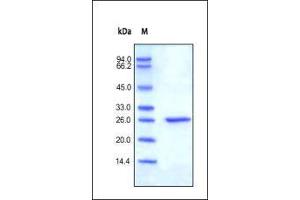Human C-Reactive Protein, His Tag (HPLC-verified) on SDS-PAGE under reducing (R) condition.