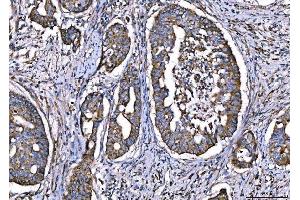 IHC analysis of CPT1A using anti-CPT1A antibody (ABIN7599853). (CPT1A Antikörper  (AA 122-556))