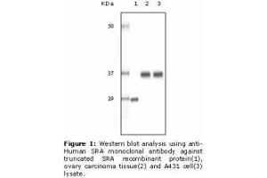Image no. 2 for anti-Steroid Receptor RNA Activator 1 (SRA1) antibody (ABIN232101)