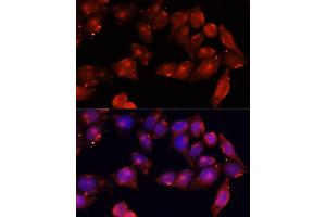 Immunofluorescence analysis of HeLa cells using B antibody (ABIN7265414) at dilution of 1:100 (40x lens). (ACVR2B Antikörper  (AA 50-150))