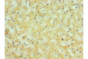 Immunohistochemistry of paraffin-embedded human liver tissue using ABIN7145505 at dilution of 1:100 (Glucuronidase beta Antikörper  (AA 382-651))