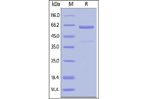 Human CD73, His Tag (Hied) on  under reducing (R) condition. (CD73 Protein (AA 27-549) (His tag))