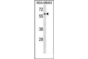 Western blot analysis of XRCC9 / FANCG Antibody (C-term) in MDA-MB453 cell line lysates (35ug/lane).