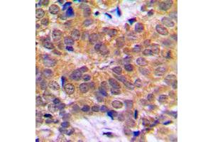 Immunohistochemistry (IHC) image for anti-Regulator of Chromosome Condensation (RCC1) and BTB (POZ) Domain Containing Protein 1 (RCBTB1) (Center) antibody (ABIN7298224)
