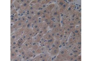 Used in DAB staining on fromalin fixed paraffin- embedded liver tissue (AGXT2 Antikörper  (AA 259-514))