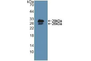 Western blot analysis of recombinant Mouse NUP85. (NUP85 Antikörper  (AA 418-653))
