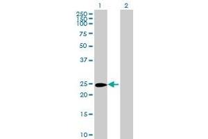 Lane 1: CRISP1 transfected lysate ( 28. (CRISP1 293T Cell Transient Overexpression Lysate(Denatured))