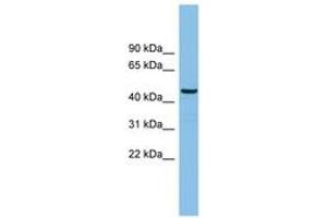 Image no. 1 for anti-HCLS1 Binding Protein 3 (HS1BP3) (AA 71-120) antibody (ABIN6745187) (HS1BP3 Antikörper  (AA 71-120))