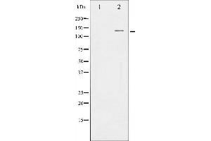 Western blot analysis of nNOS expression in INF treated RAW264.