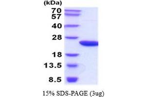 SDS-PAGE (SDS) image for Retinol Binding Protein 4, Plasma (RBP4) (AA 19-201) protein (His tag) (ABIN6387731)