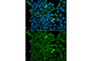 Immunofluorescence analysis of A549 cell using RNF125 antibody.