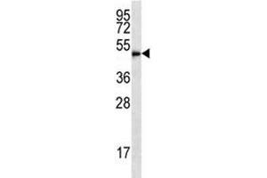 Western Blotting (WB) image for anti-Histone Deacetylase 3 (HDAC3) (AA 383-412) antibody (ABIN3031229)
