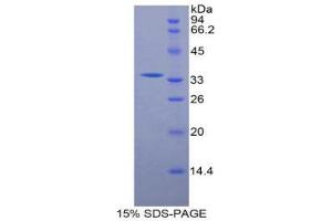 SDS-PAGE (SDS) image for Ornithine Carbamoyltransferase (OTC) (AA 78-129) protein (His tag) (ABIN1879606)
