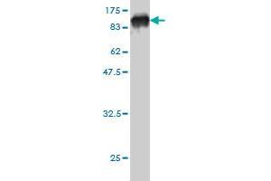 Western Blot detection against Immunogen (94. (PDIA4 Antikörper  (AA 21-645))