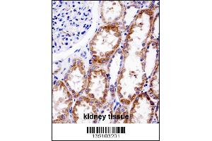 DNMT3A Antibody (Center R478WMutant) immunohistochemistry analysis in formalin fixed and paraffin embedded human kidney tissue followed by peroxidase conjugation of the secondary antibody and DAB staining. (DNMT3A Antikörper  (AA 457-486))