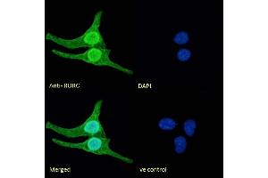 (ABIN625825) Immunofluorescence analysis of paraformaldehyde fixed U2OS cells, permeabilized with 0.