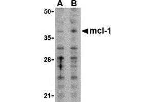 Western Blotting (WB) image for anti-Induced Myeloid Leukemia Cell Differentiation Protein Mcl-1 (MCL1) (N-Term) antibody (ABIN1031455) (MCL-1 Antikörper  (N-Term))