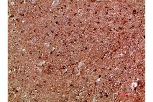 Immunohistochemical analysis of paraffin-embedded human-brain, antibody was diluted at 1:200 (IKBKG Antikörper  (AA 60-120))