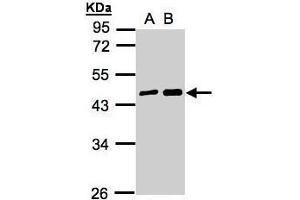 WB Image Sample(30 ug whole cell lysate) A:A431, B:H1299 10% SDS PAGE antibody diluted at 1:5000 (MAGEA11 Antikörper  (N-Term))