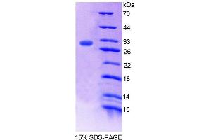 SDS-PAGE (SDS) image for Runt-Related Transcription Factor 3 (RUNX3) (AA 1-250) protein (His tag) (ABIN6239502) (RUNX3 Protein (AA 1-250) (His tag))