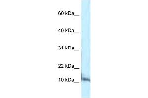 WB Suggested Anti-Pcbd1 Antibody Titration: 1. (PCBD1 Antikörper  (C-Term))