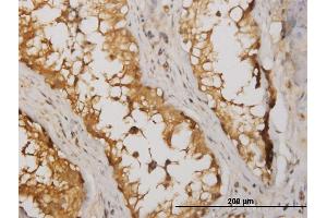 Immunostaining (ISt) image for anti-Nucleoside diphosphate kinase B (NME2) (AA 51-152) antibody (ABIN518376)