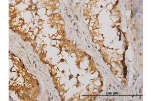 Immunoperoxidase of monoclonal antibody to NME2 on formalin-fixed paraffin-embedded human testis. (NME2 Antikörper  (AA 51-152))