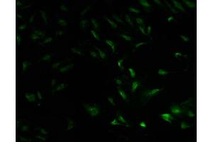 Immunofluorescence staining of Hela cells with ABIN7142045 at 1:100, counter-stained with DAPI. (Phospholipase C beta 2 Antikörper  (AA 1031-1185))